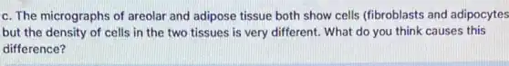c. The micrographs of areolar and adipose tissue both show cells (fibroblasts and adipocytes
but the density of cells in the two tissues is very different What do you think causes this
difference?