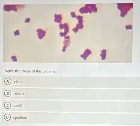 Name the shape of this bacteria:
A vibrio
B coccus
C bacilli
D spirillum